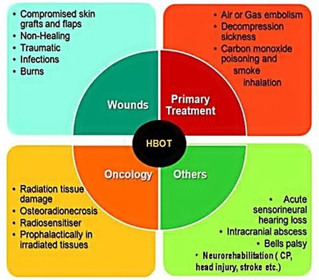 Hyperbaric-Oxygen-Therapy80fb498e41df585d.jpg